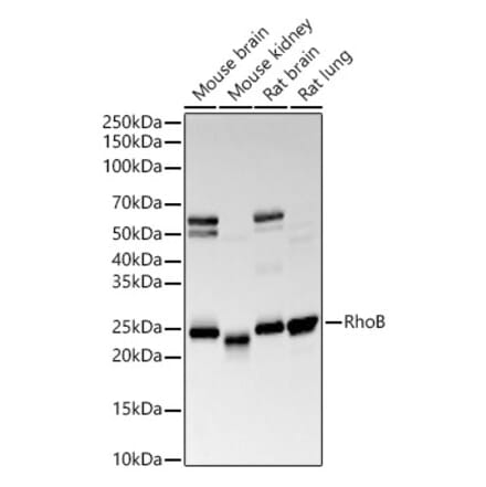 Western Blot - Anti-RhoB Antibody [ARC56483] (A308513) - Antibodies.com