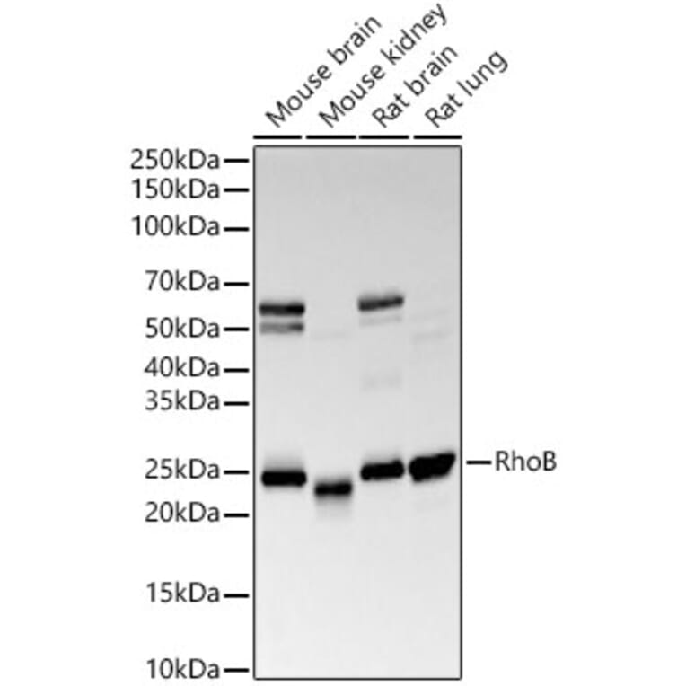 Western Blot - Anti-RhoB Antibody [ARC56483] (A308513) - Antibodies.com