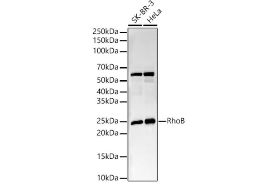 Western Blot - Anti-RhoB Antibody [ARC56483] (A308513) - Antibodies.com
