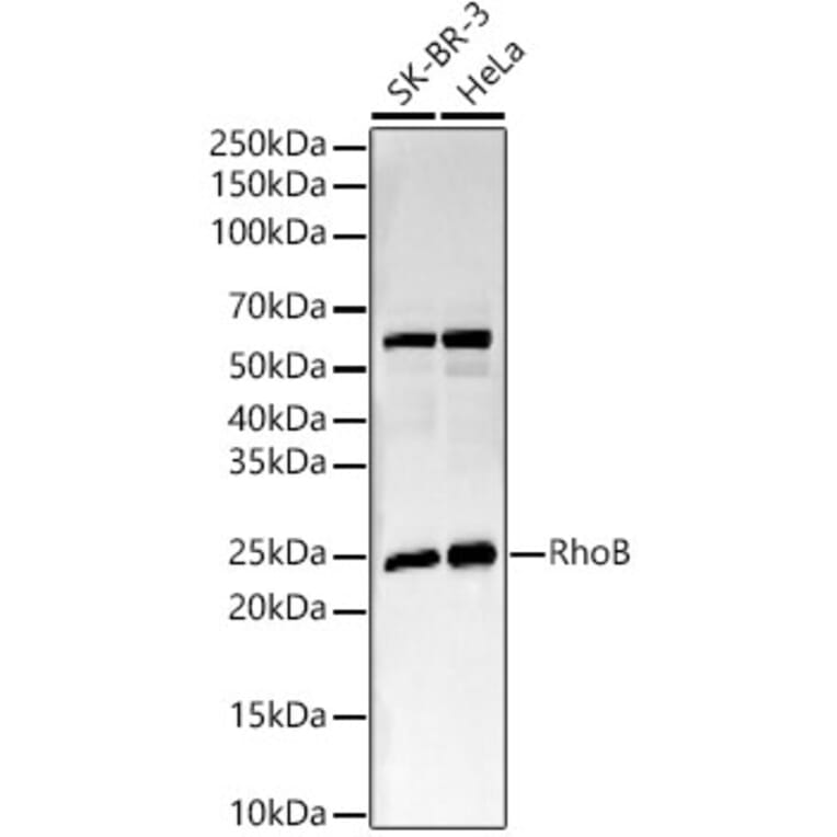 Western Blot - Anti-RhoB Antibody [ARC56483] (A308513) - Antibodies.com