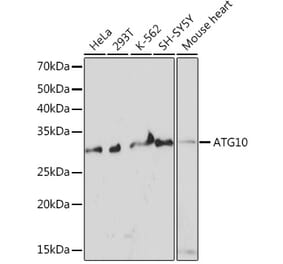 Western Blot - Anti-ATG10 Antibody [ARC1425] (A308514) - Antibodies.com