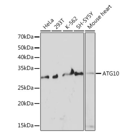 Western Blot - Anti-ATG10 Antibody [ARC1425] (A308514) - Antibodies.com