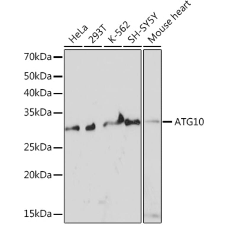 Western Blot - Anti-ATG10 Antibody [ARC1425] (A308514) - Antibodies.com