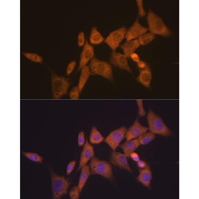 Immunofluorescence - Anti-ATG10 Antibody [ARC1425] (A308514) - Antibodies.com