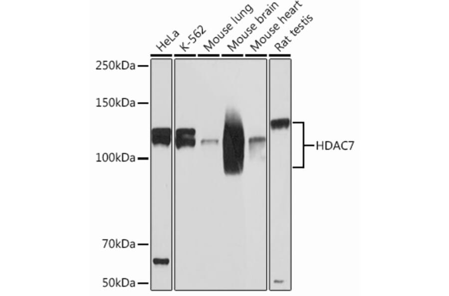 Western Blot - Anti-HDAC7 Antibody [ARC0713] (A308515) - Antibodies.com