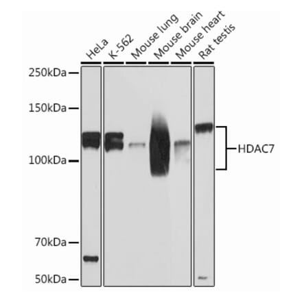 Western Blot - Anti-HDAC7 Antibody [ARC0713] (A308515) - Antibodies.com