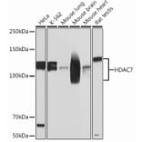 Western Blot - Anti-HDAC7 Antibody [ARC0713] (A308515) - Antibodies.com