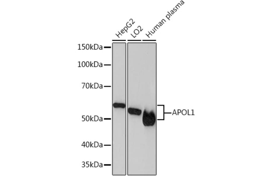 Western Blot - Anti-Apolipoprotein L1/APOL1 Antibody [ARC1124] (A308516) - Antibodies.com