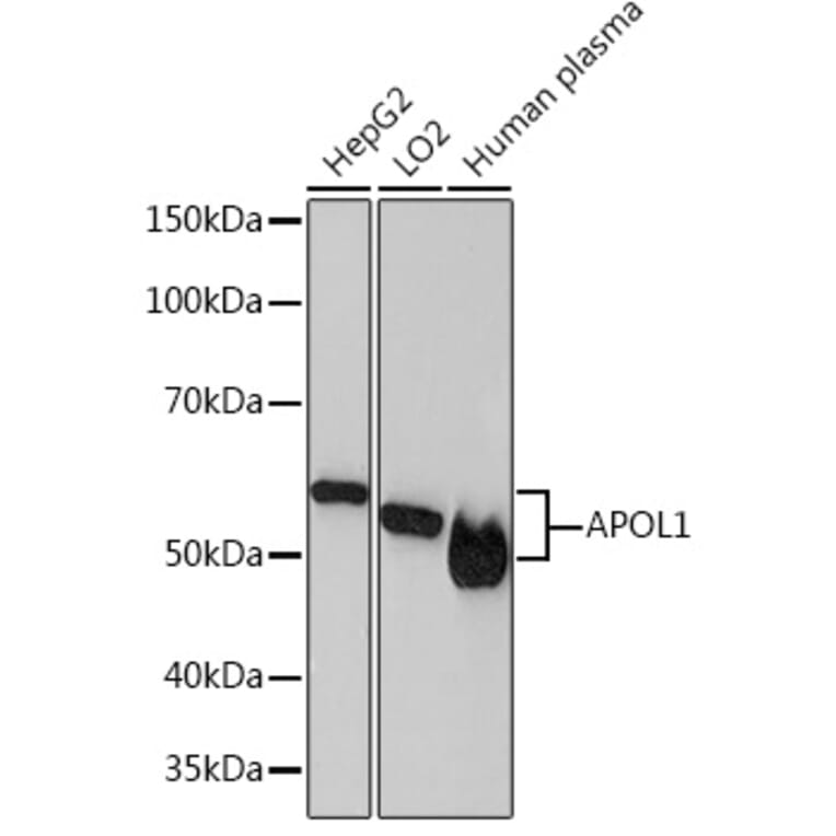 Western Blot - Anti-Apolipoprotein L1/APOL1 Antibody [ARC1124] (A308516) - Antibodies.com