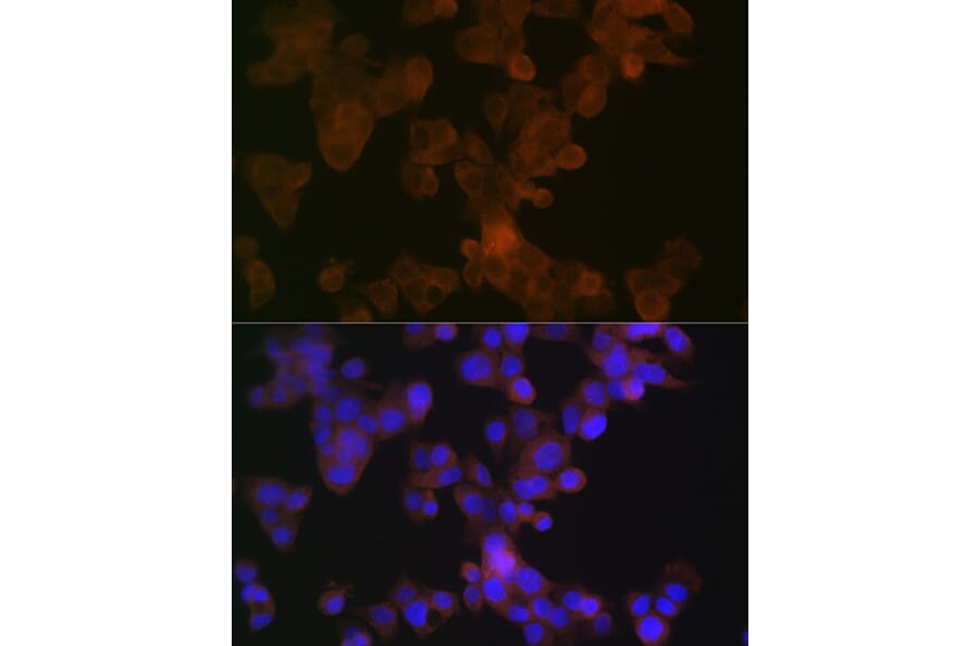 Immunofluorescence - Anti-Apolipoprotein L1/APOL1 Antibody [ARC1124] (A308516) - Antibodies.com
