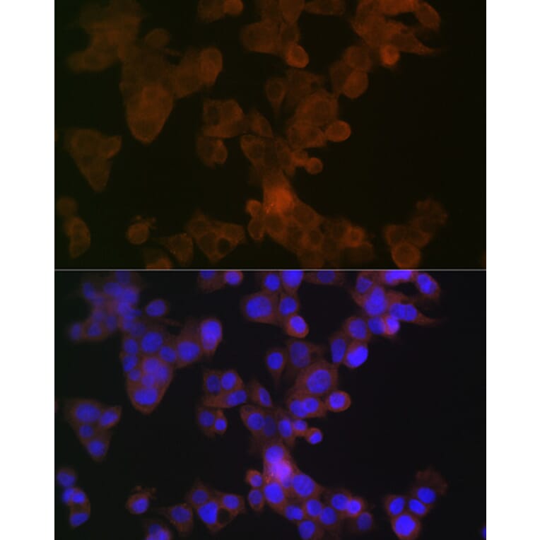 Immunofluorescence - Anti-Apolipoprotein L1/APOL1 Antibody [ARC1124] (A308516) - Antibodies.com