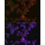 Immunofluorescence - Anti-Apolipoprotein L1/APOL1 Antibody [ARC1124] (A308516) - Antibodies.com