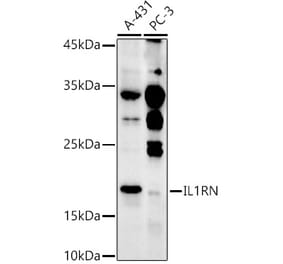 Western Blot - Anti-IL-1RA Antibody (A308517) - Antibodies.com
