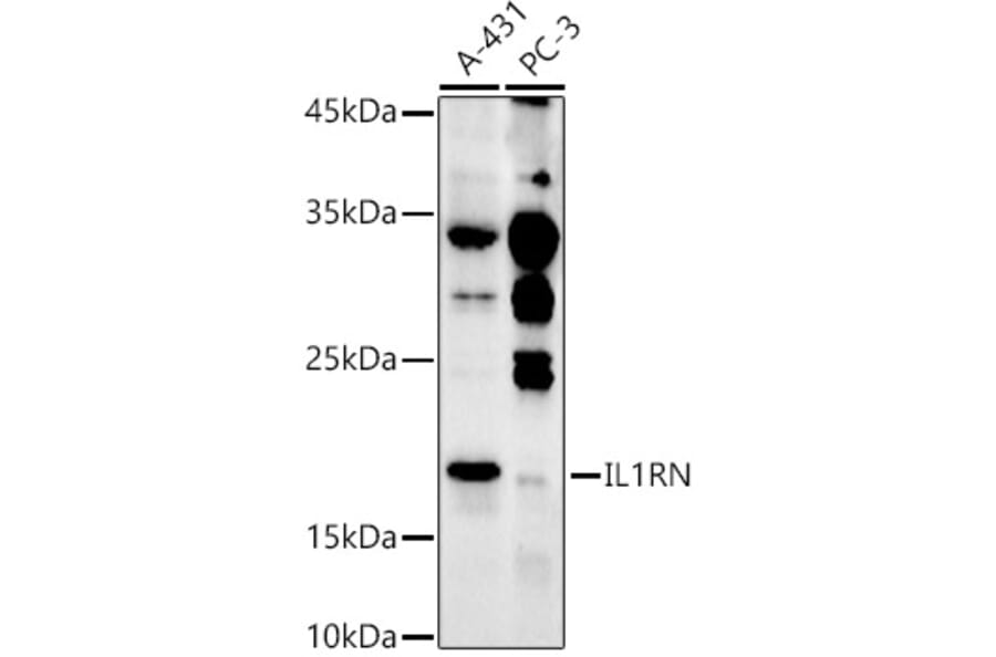 Western Blot - Anti-IL-1RA Antibody (A308517) - Antibodies.com