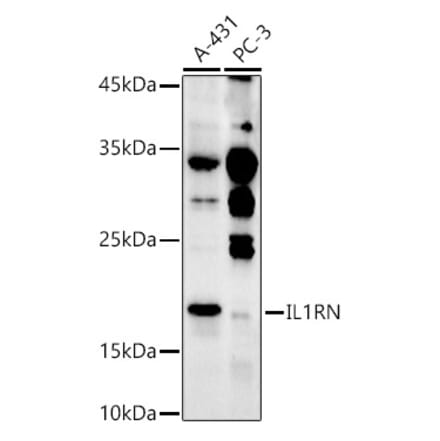Western Blot - Anti-IL-1RA Antibody (A308517) - Antibodies.com