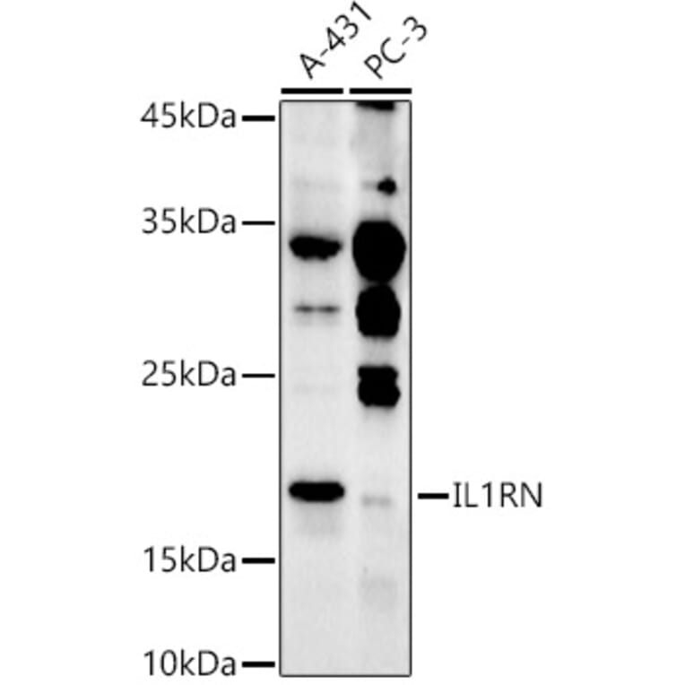 Western Blot - Anti-IL-1RA Antibody (A308517) - Antibodies.com