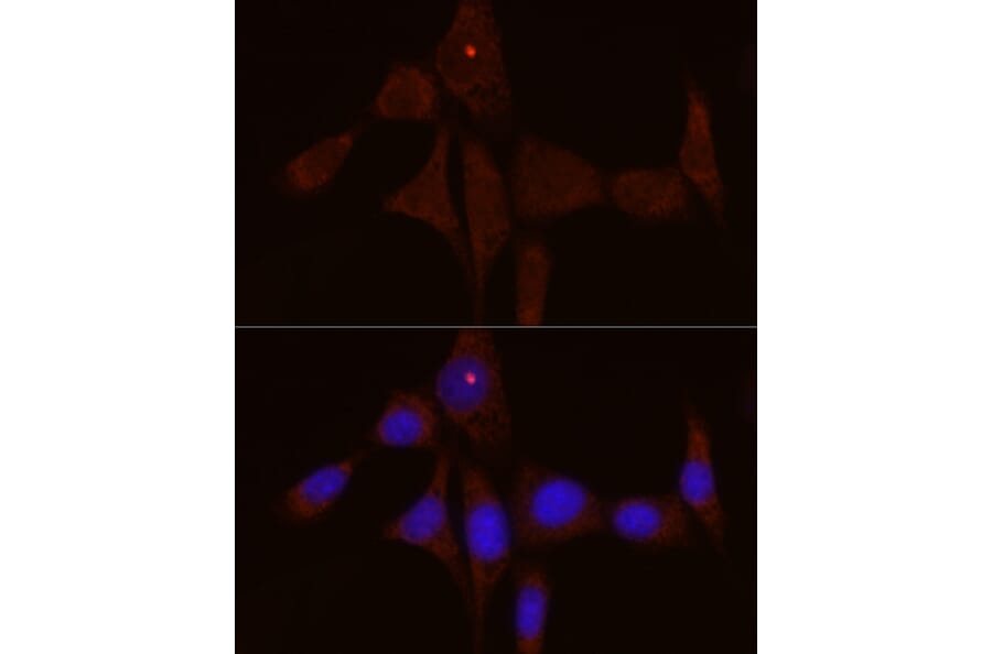 Immunofluorescence - Anti-IL-1RA Antibody (A308517) - Antibodies.com