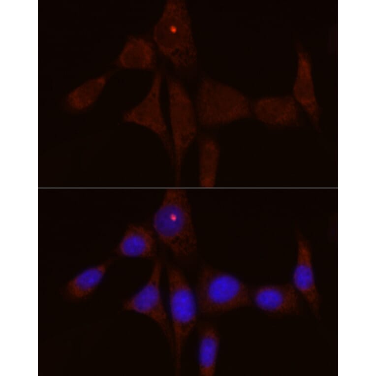 Immunofluorescence - Anti-IL-1RA Antibody (A308517) - Antibodies.com
