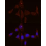 Immunofluorescence - Anti-IL-1RA Antibody (A308517) - Antibodies.com