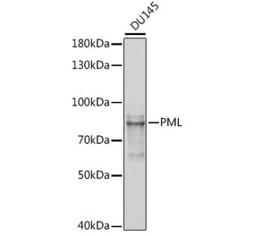 Western Blot - Anti-PML Protein Antibody (A308518) - Antibodies.com
