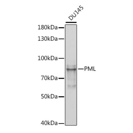 Western Blot - Anti-PML Protein Antibody (A308518) - Antibodies.com