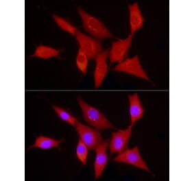 Immunofluorescence - Anti-PDGF B Antibody [ARC53713] (A308520) - Antibodies.com