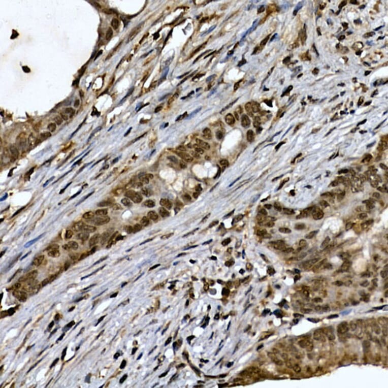 Immunohistochemistry - Anti-ZNF213 Antibody (A308521) - Antibodies.com