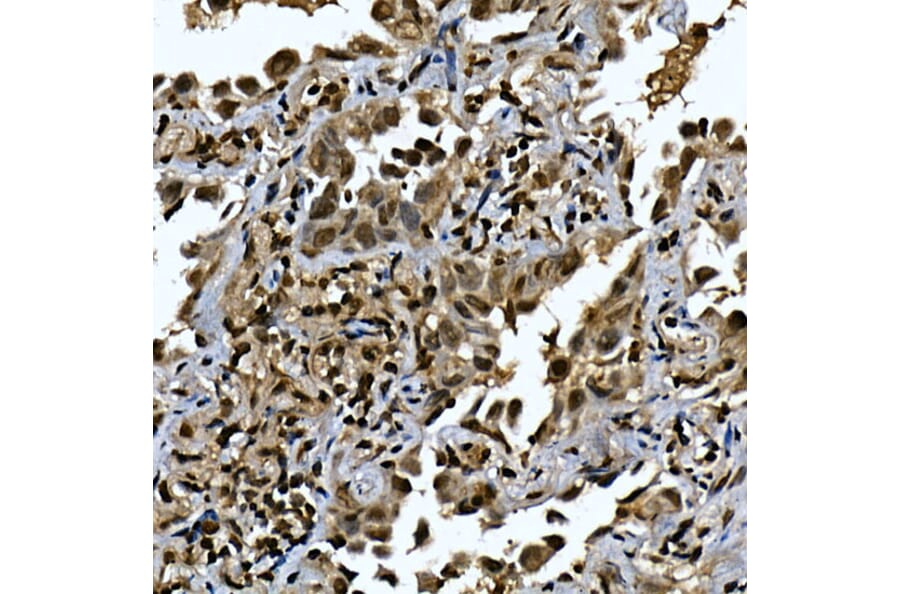 Immunohistochemistry - Anti-ZNF213 Antibody (A308521) - Antibodies.com