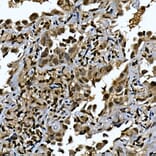 Immunohistochemistry - Anti-ZNF213 Antibody (A308521) - Antibodies.com