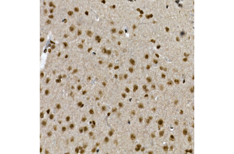 Immunohistochemistry - Anti-ZNF213 Antibody (A308521) - Antibodies.com