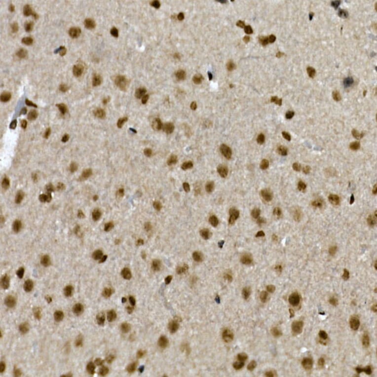 Immunohistochemistry - Anti-ZNF213 Antibody (A308521) - Antibodies.com