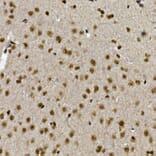 Immunohistochemistry - Anti-ZNF213 Antibody (A308521) - Antibodies.com