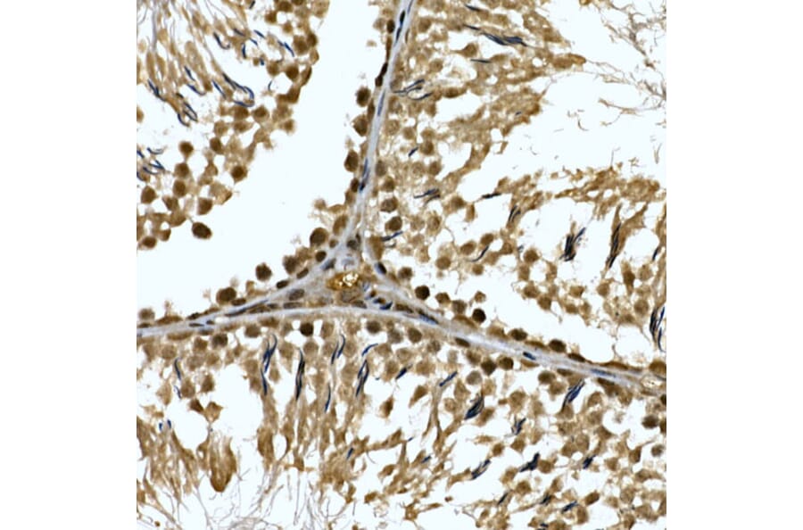 Immunohistochemistry - Anti-ZNF213 Antibody (A308521) - Antibodies.com
