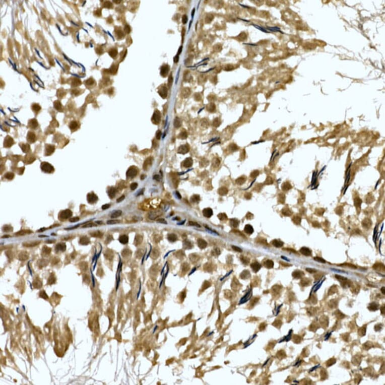 Immunohistochemistry - Anti-ZNF213 Antibody (A308521) - Antibodies.com