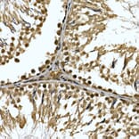 Immunohistochemistry - Anti-ZNF213 Antibody (A308521) - Antibodies.com