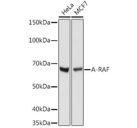 Western Blot - Anti-A RAF Antibody [ARC1782] (A308522) - Antibodies.com