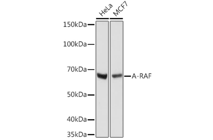 Western Blot - Anti-A RAF Antibody [ARC1782] (A308522) - Antibodies.com