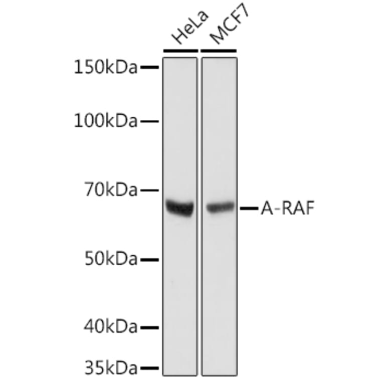 Western Blot - Anti-A RAF Antibody [ARC1782] (A308522) - Antibodies.com
