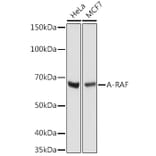 Western Blot - Anti-A RAF Antibody [ARC1782] (A308522) - Antibodies.com