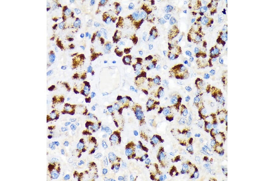 Immunohistochemistry - Anti-A RAF Antibody [ARC1782] (A308522) - Antibodies.com