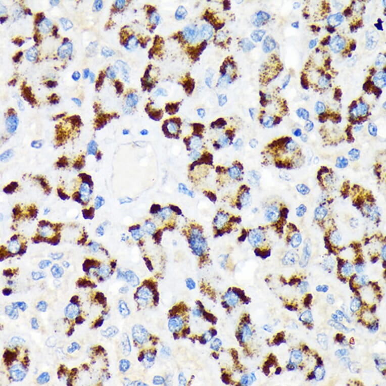 Immunohistochemistry - Anti-A RAF Antibody [ARC1782] (A308522) - Antibodies.com