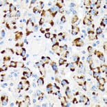 Immunohistochemistry - Anti-A RAF Antibody [ARC1782] (A308522) - Antibodies.com