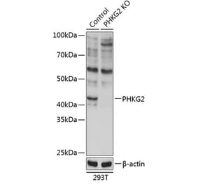 Western Blot - Anti-PHKG2 Antibody (A308523) - Antibodies.com