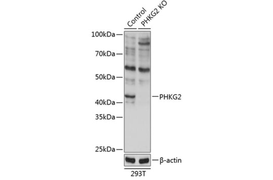 Western Blot - Anti-PHKG2 Antibody (A308523) - Antibodies.com