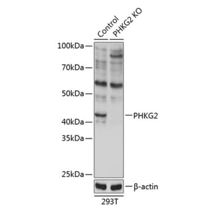 Western Blot - Anti-PHKG2 Antibody (A308523) - Antibodies.com