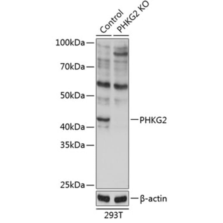 Western Blot - Anti-PHKG2 Antibody (A308523) - Antibodies.com