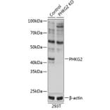 Western Blot - Anti-PHKG2 Antibody (A308523) - Antibodies.com