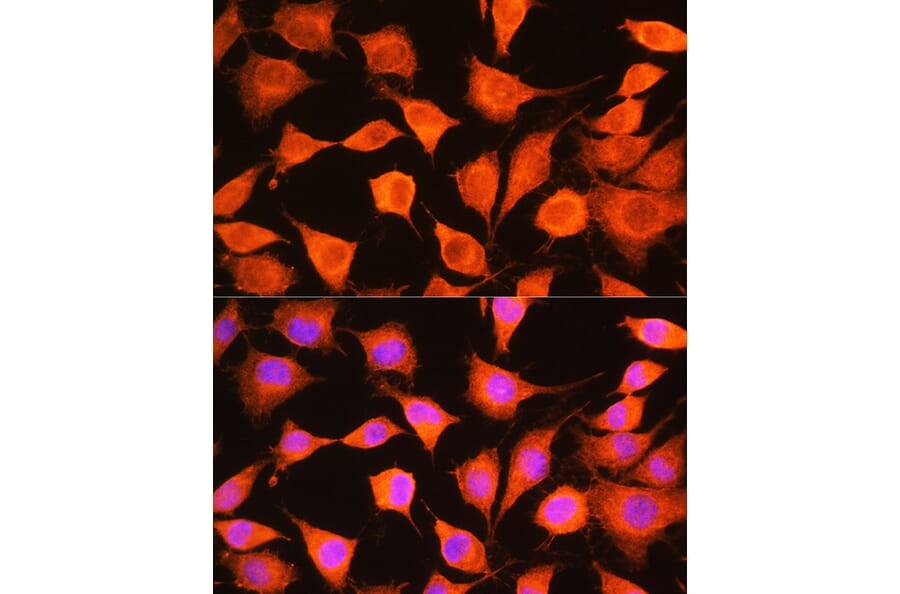 Immunofluorescence - Anti-PHKG2 Antibody (A308523) - Antibodies.com