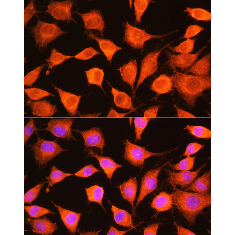 Immunofluorescence - Anti-PHKG2 Antibody (A308523) - Antibodies.com