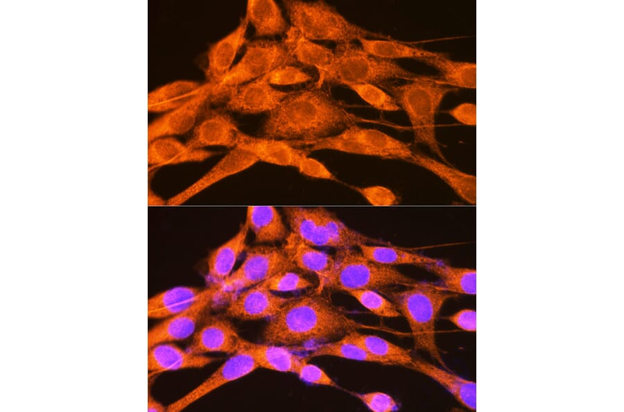Immunofluorescence - Anti-PHKG2 Antibody (A308523) - Antibodies.com